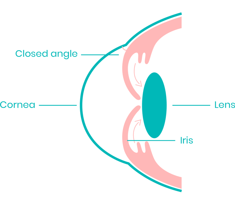 https://www.shivjyotieyehospital.com/wp-content/uploads/2023/12/image2-3.png