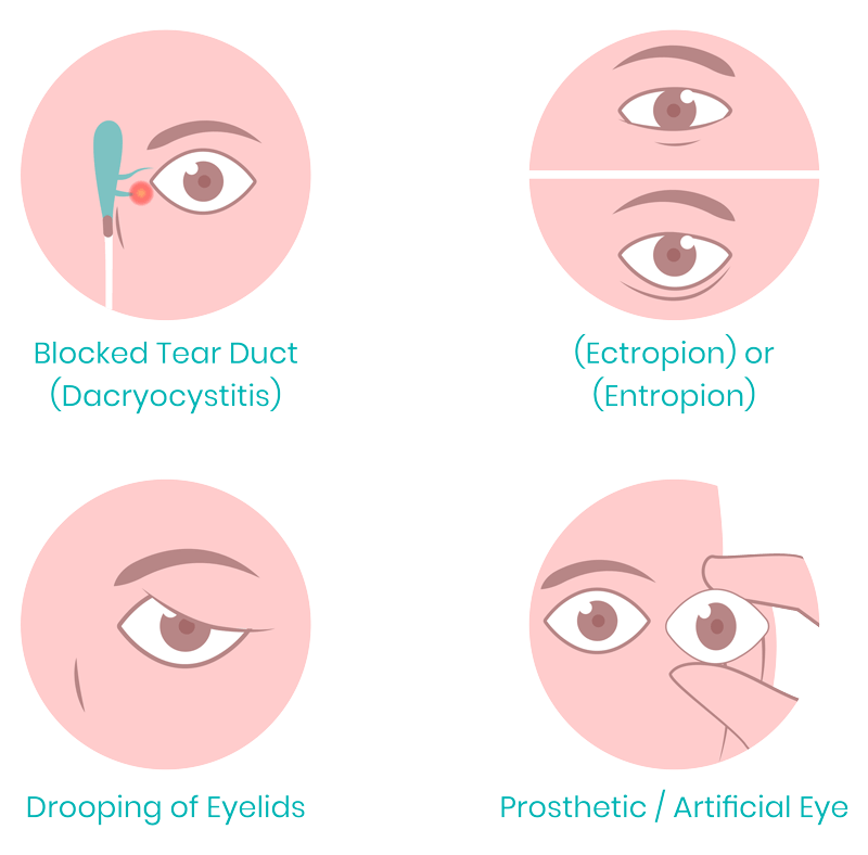 https://www.shivjyotieyehospital.com/wp-content/uploads/2023/12/image2.png