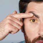 Eye Flu Symptoms, Causes & Prevention: How to Protect Your Eyes